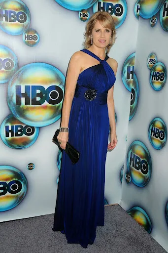 Kim Dickens Hot Sexy Bikini Pictures